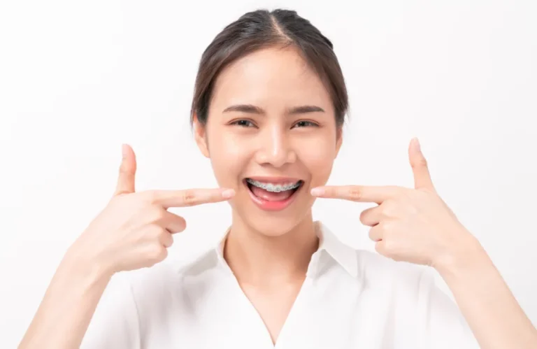จัดฟันแบบไหนดี แต่ละแบบมีข้อดีและข้อเสียอย่างไร